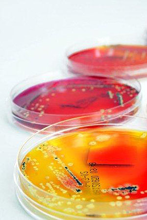 hygiene survery, testing for Air plates Aspergillus spp., Bacillus cereus, Clostridia spp., Coliforms, Disinfectant and cleaning efficacy, E. coli, Faecal coliforms, Fungal and bacterial identification, Fusarium spp., Lactobacillus spp., Salmonella spp., Shigella spp.